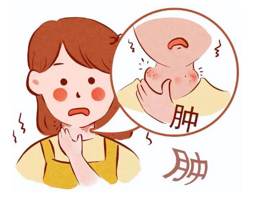甲状腺结节